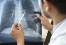 Tabagismo é maior entre jovens de 16 a 24 anos, alerta pesquisa