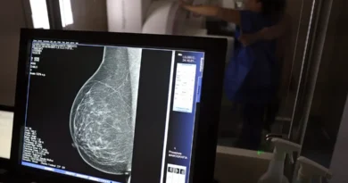 Médicos lançam guia para evitar recusa de mamografia digital